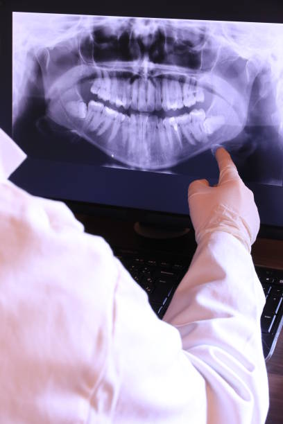 Best Emergency Dental Care for Broken or Chipped Teeth in Southside Place, TX
